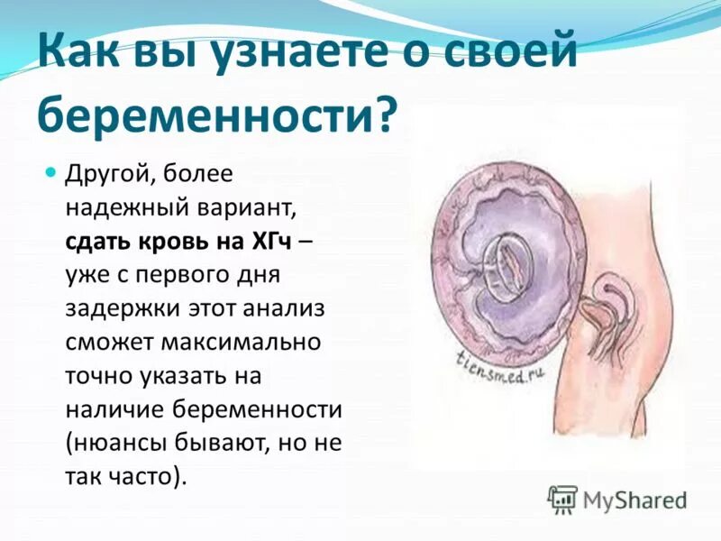 Течение 1 2 недель после. Как определить беременность. Как понять что беременна. Как узанть т беременности. Как узнать что забеременела.