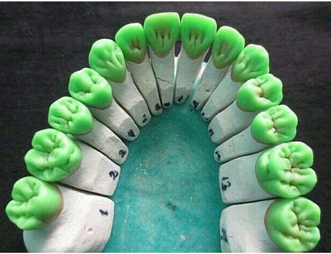 Название зубов и их функции. Медиальный резец верхней челюсти форма. Резцы клыки малые и большие коренные зубы. Резцов жевательные зубы. Резцы клыки премоляры.