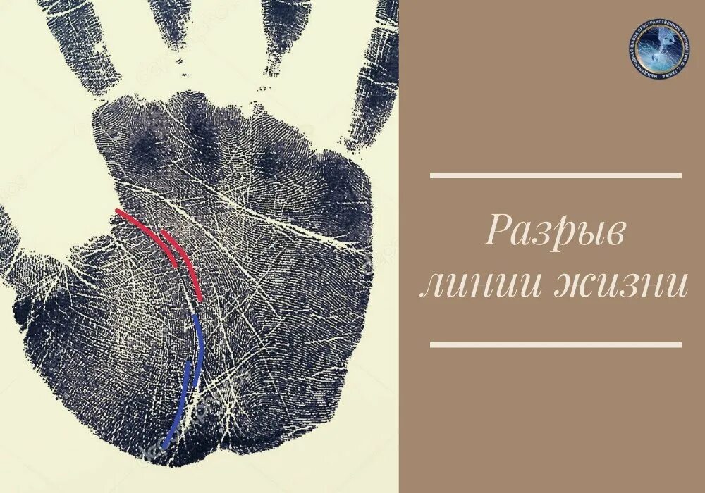 Хиромантия линия жизни с разрывом. Сплин линия жизни текст. Линия жизни mp3. Линия жизни mp3. Линии судьбы.