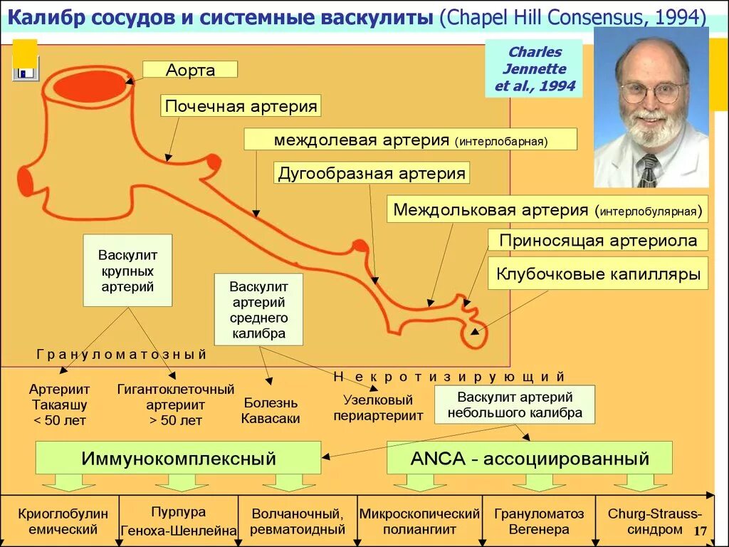 Системные васкулиты патогенез схема. Васкулит классификация что это такое. Системные васкулиты клинические формы. Системные васкулиты у детей классификация. Системные васкулиты клинические