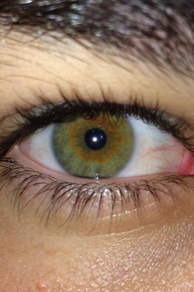 Глаза хамелеоны у человека. Центральная гетерохромия карих глаз. Центральная гетерохромия хамелеон. Центральная гетерохромия зеленый Карий. Центральная гетерохромия глаз Карий и зеленый.