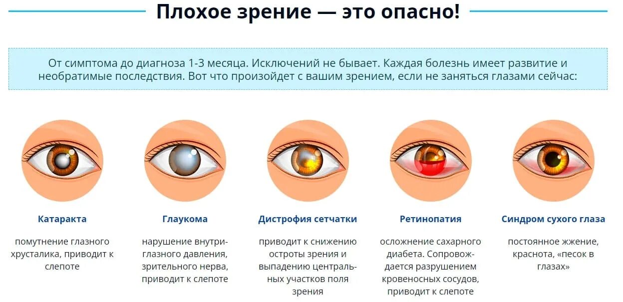 Катаракта глаза симптомы. Заболевание глаз глаукома. Катаракта – помутнение хрусталика глаза.. При недостатке какого витамина ухудшается зрение