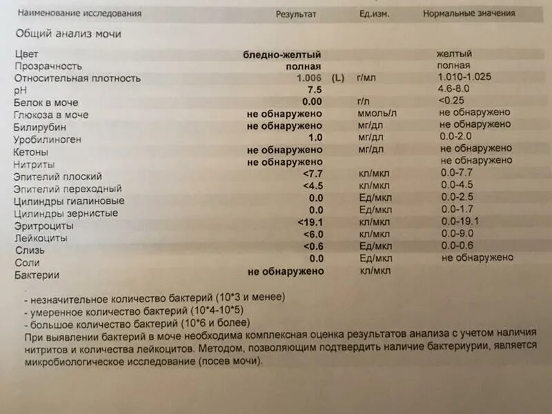 Анализ мочи. Общий анализ мочи. Общий анализ мочи при. Плохой анализ мочи.