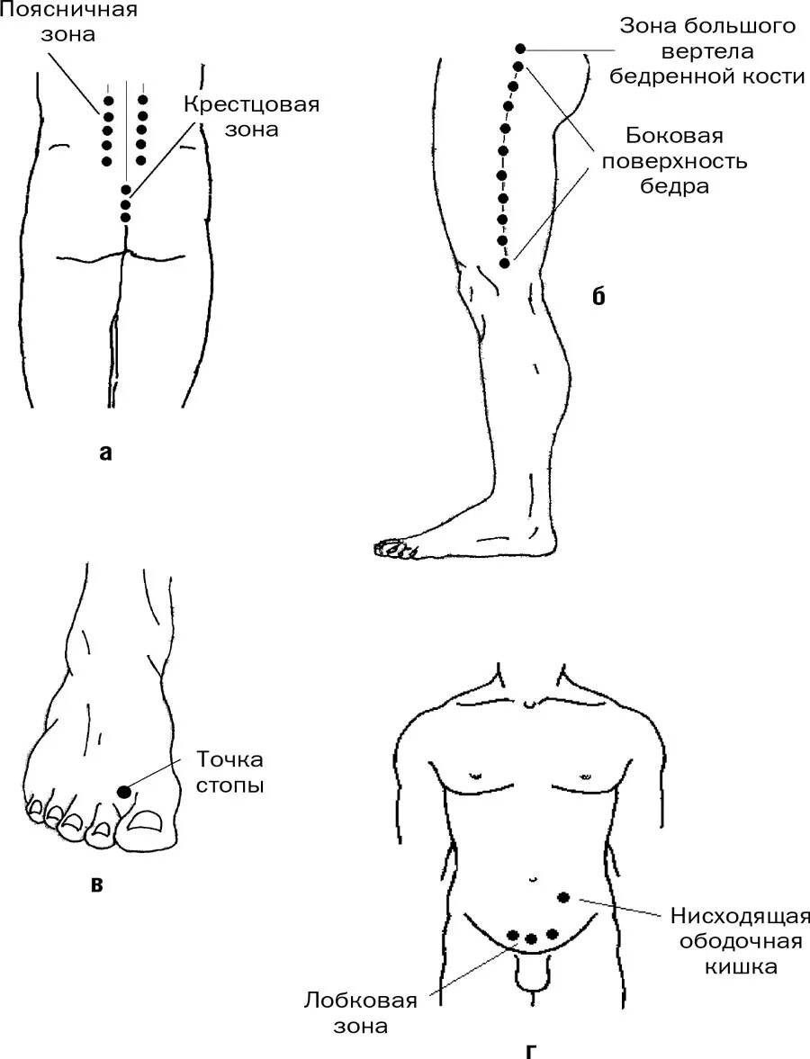 Точки на пояснице. Точки на бедрах. Проекция вертела бедренной кости. Болезненность в проекции вертела бедренной кости. Зона поясницы.