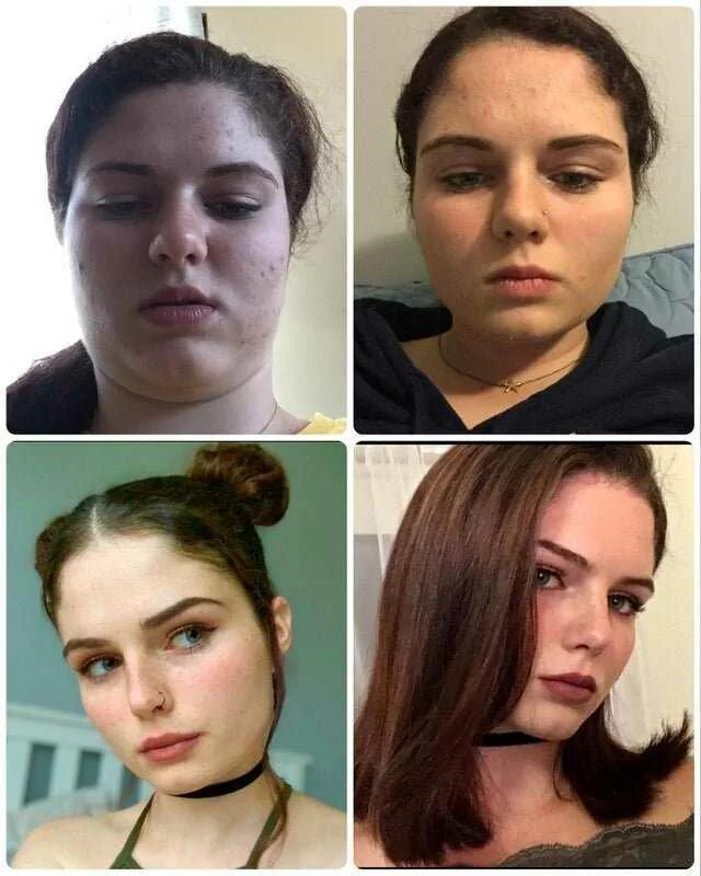 Светлана иванова до и после ринопластики. Измениться до неузнаваемости задания. Фото девушек которые кардинально изменили образ. Знаменитости которые сохранили молодость. Девушки которые изменились до неузнаваемости.