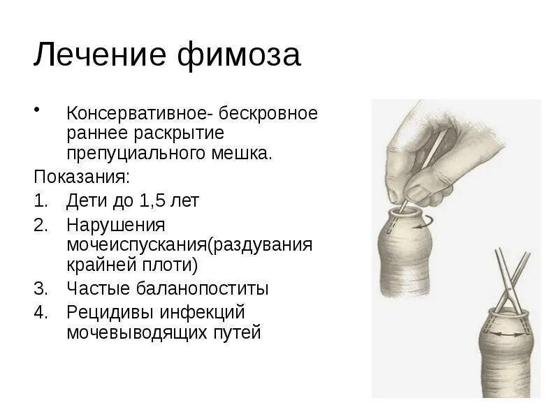 У ребенка под крайней плотью