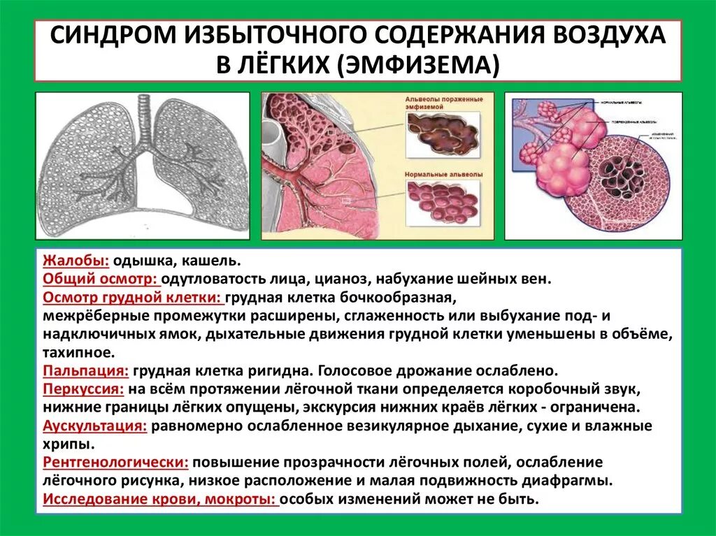 Синдромы мокроты. Эмфизема лёгких симптомы. Для эмфиземы легких характерно.