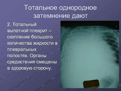 Что такое затемнение