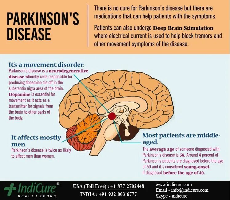 Parkinson's disease Brain. ДИИП брайин Стимулейшн. Parkinson disease статистика. Болезнь Паркинсона расположение в мозге.