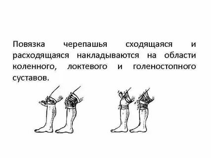 Коленные локтевые и голеностопные