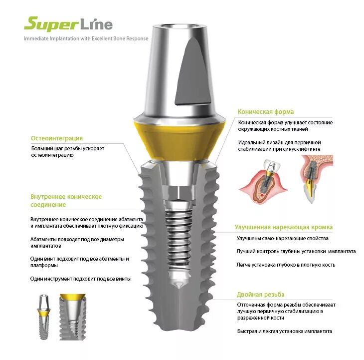 Имплант лайн. Имплантация Dentium Superline. Имплант Дентиум Имплантиум Суперлайн. Имплантация формирователь Dentium. Система Дентиум импланты.