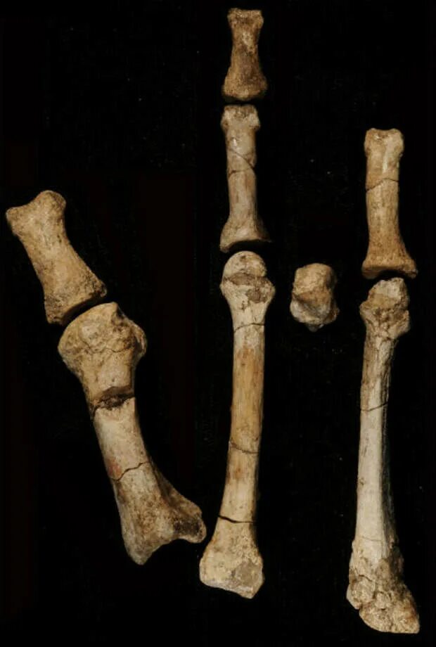 Название трех костей. Человеческие кости. Человеческие косточки. Окаменелые человеческие кости.