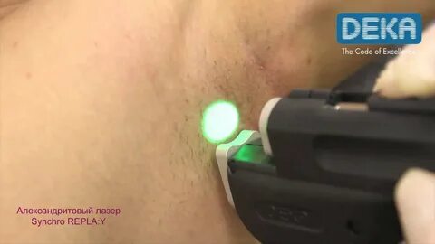 Александритовый лазер deka moveo