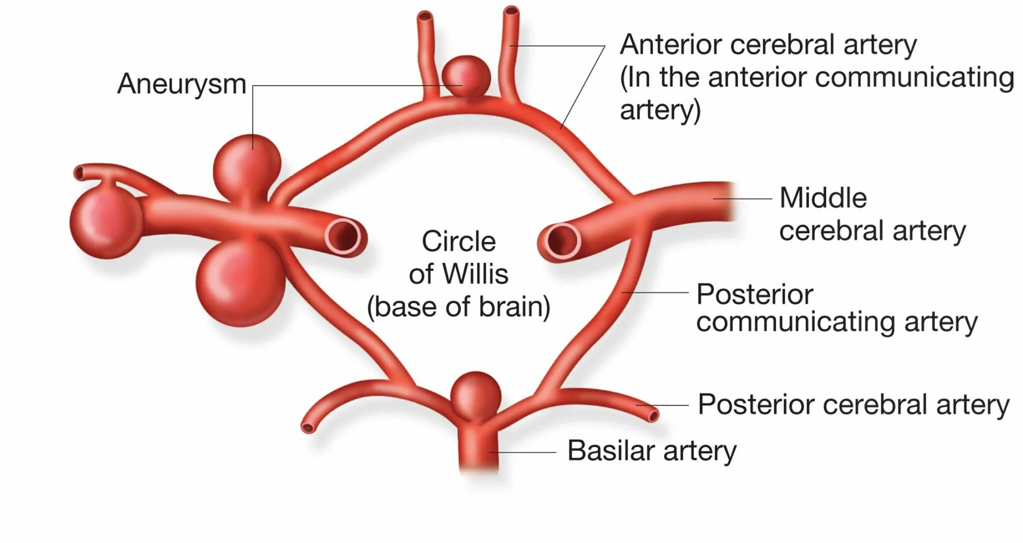 Аневризм Виллизиева круга. Виллизиев круг задние соединительные артерии. Передняя соединительная артерия головного мозга аневризма. Локализация аневризм головного мозга.