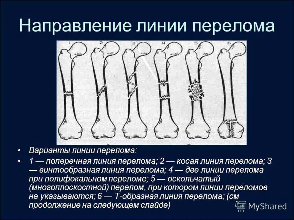 По направлению ответа
