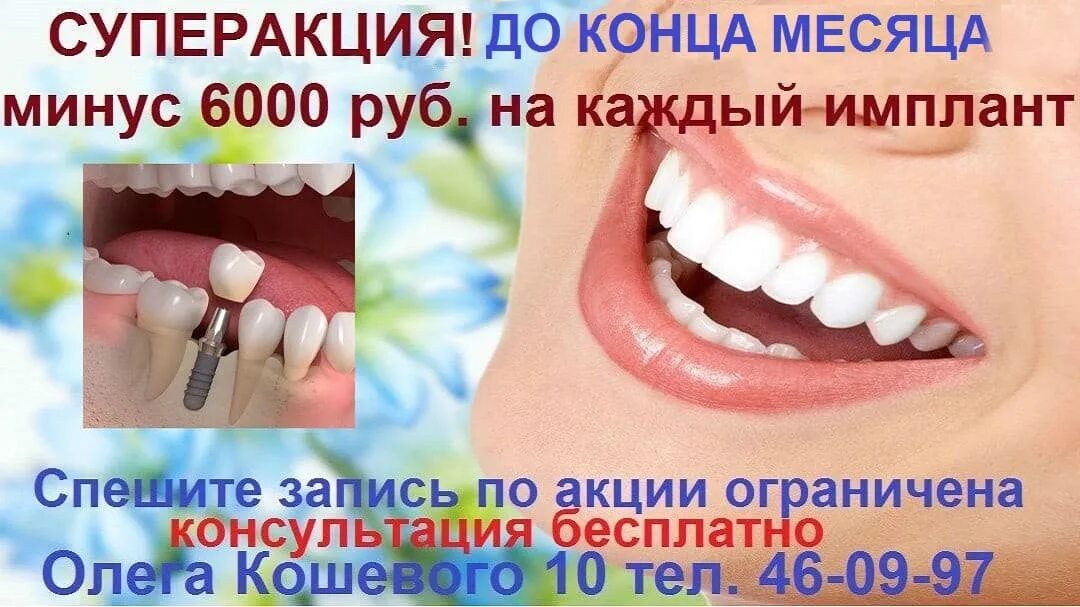 Вставить зубы вологда. Вставить зубы вологда
