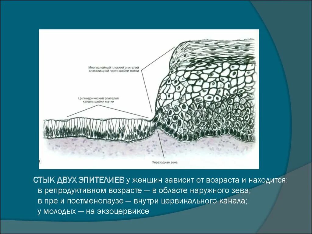 Строение многослойного плоского эпителия шейки матки. Переходная зона эпителия шейки матки. Шейка матки цилиндрический эпителий. Покровный эпителий матки. Эндоцервикс цилиндрический