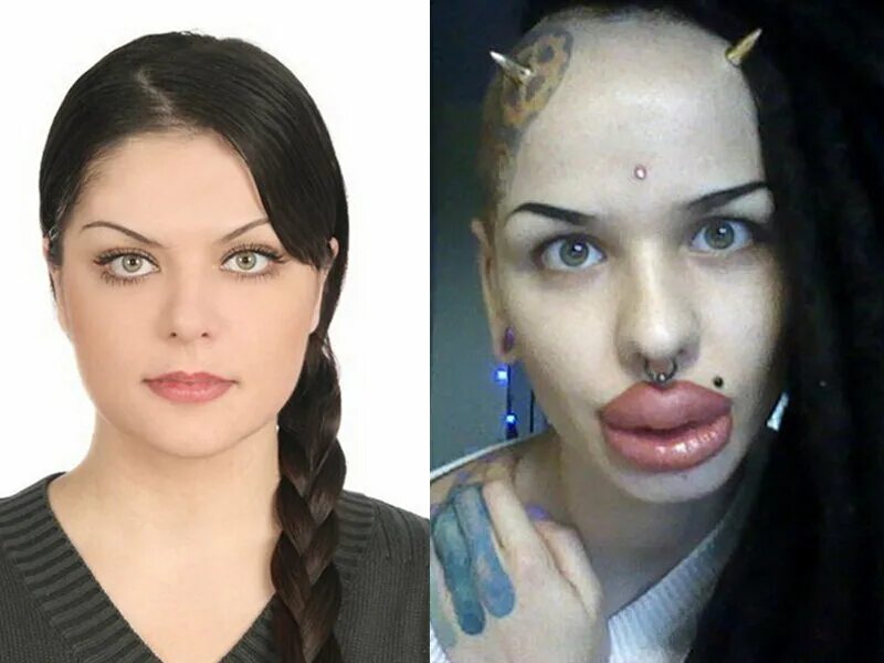 Джоселин вильденштейн до операций. Девушка после пластической операции. Девушка после пластической операции. Юлия тарасевич сейчас 2022. Донателла версаче 1997.