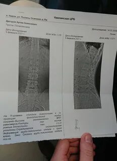 Флюорография для военкомата