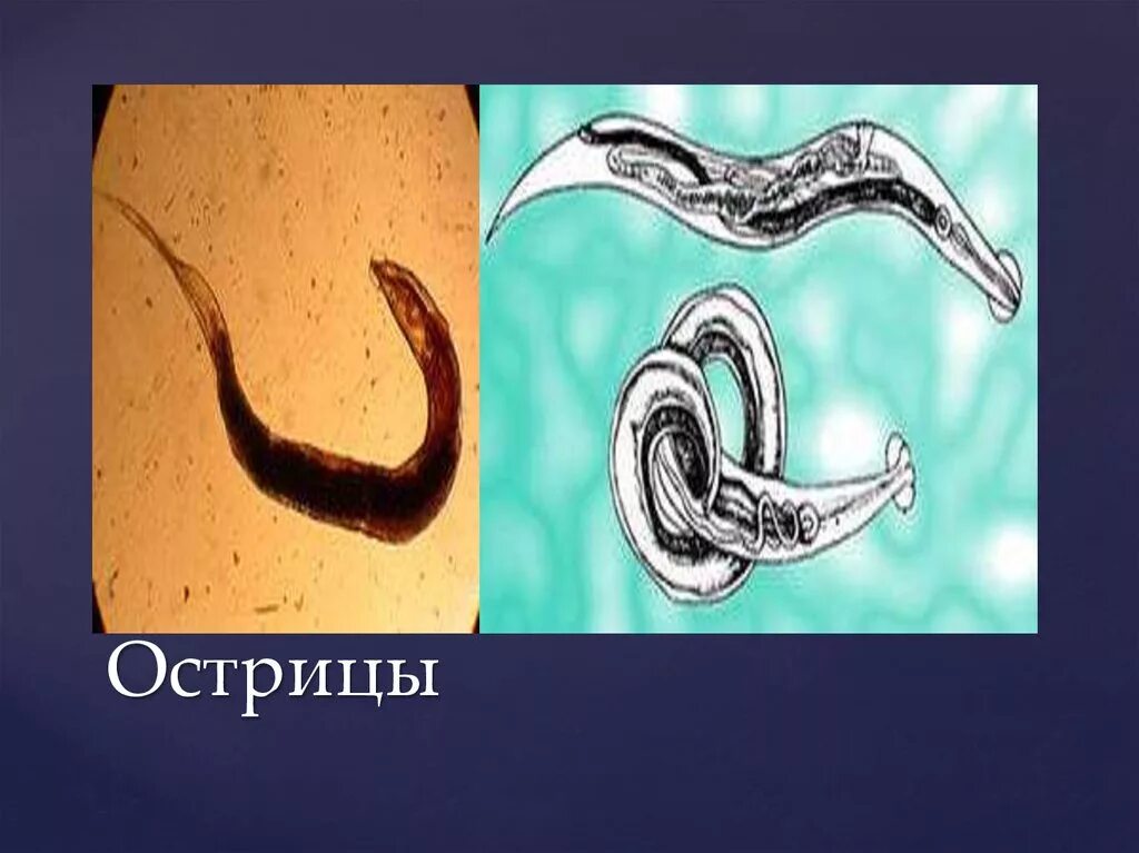 Острица детская enterobius vermicularis. Белые червячки острицы. Острицы половых. Острицы половых. Власоглав человеческий (trichocephalus trichiurus).