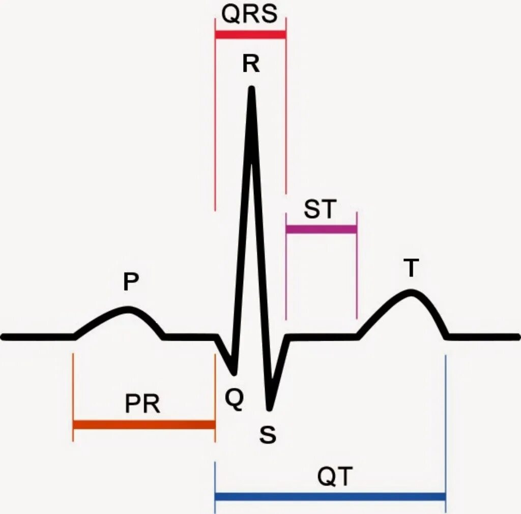 Депрессия сегмента PR на ЭКГ. Комплекс QRS на ЭКГ. ЭКГ зубцы интервалы комплексы сегменты. Зубец QRS на ЭКГ. Зубцы экг в норме