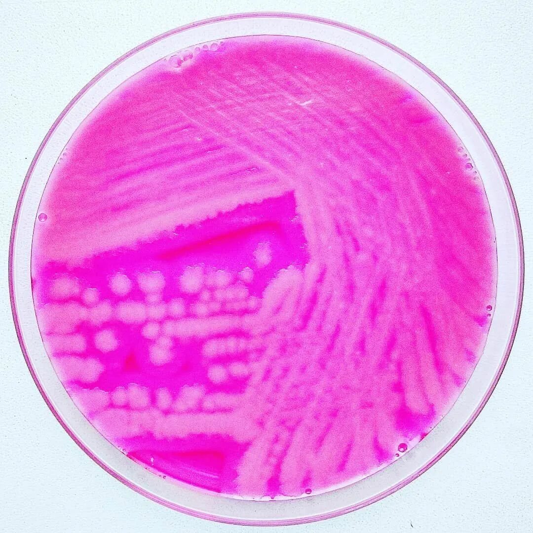 Bacillus cereus – Telegraph