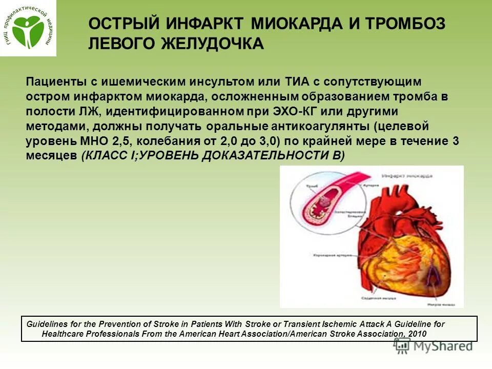 Тромб в желудочке