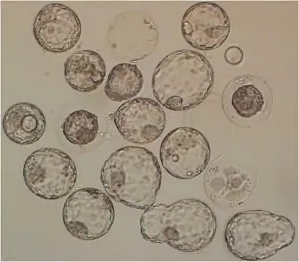 Бластоцисты (blastocystis spp. Цист в кале. Бластоцисты spp. Blastocystis hominis под микроскопом. Бластоцисты кал.
