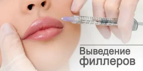 Выведение филлера