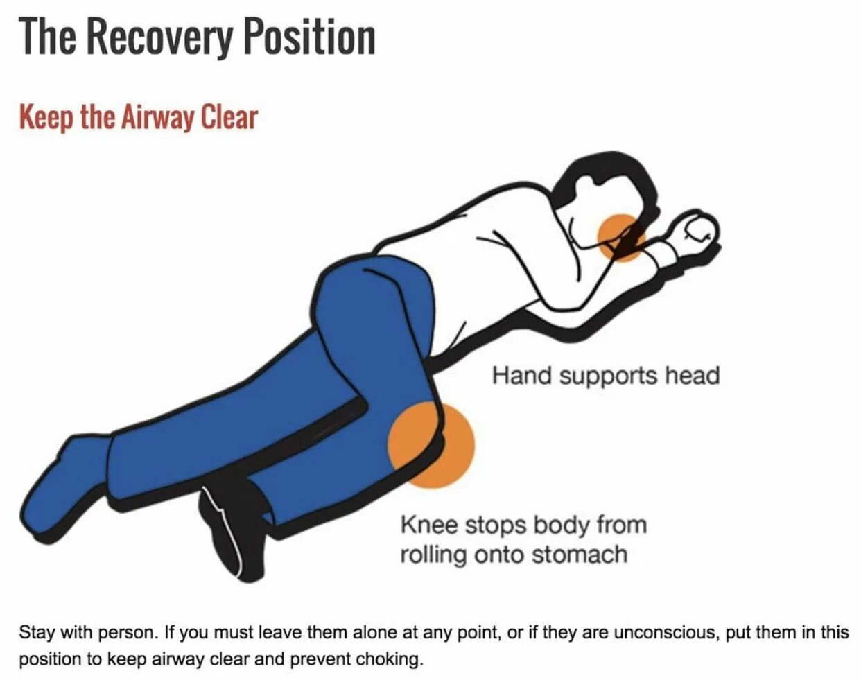 I am on position. Recovery position. recovery position first aid. рекавери. recovery position steps.