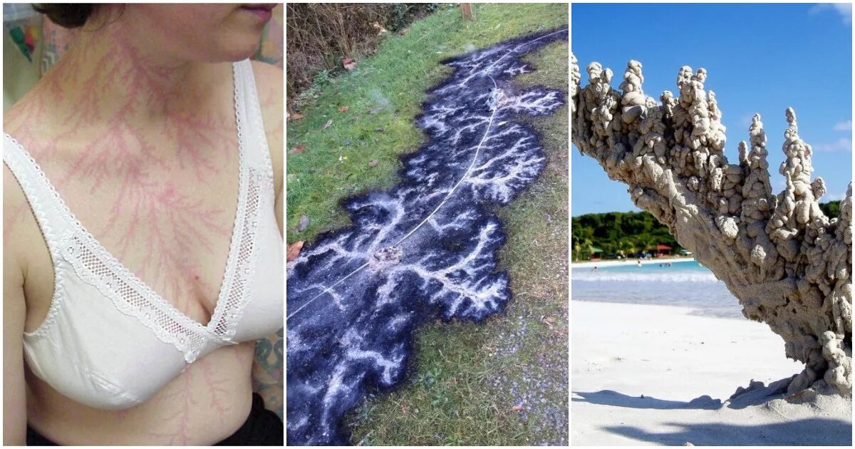 Расстояние от грозы между молнией и громом. Как происходит звук грома и молнии. Фигуры лихтенберга удар молнии. Секунды после молнии. Молния попала в дерево.