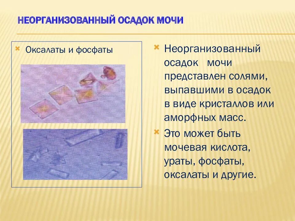 Расшифровка анализа мочи оксалаты в моче. Оксалаты кальция в осадке мочи. Норма оксалатов кальция в моче мкл. Кристаллы оксалаты в моче что это. Кристаллы оксалата кальция.