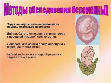 Приемы леопольда