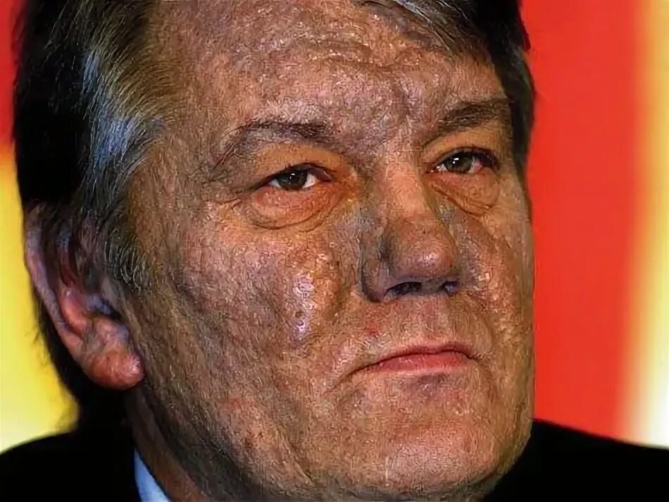 Ющенко. Ющенко 2006. Ющенко лепра. Ющенко лепра. Ющенко лепра.