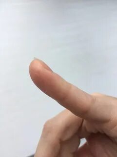 Палец без подушечки