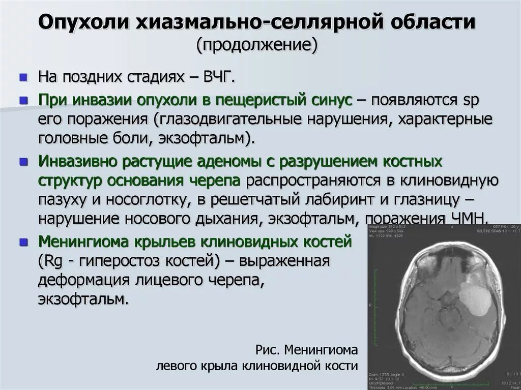 Опухоли головного мозга презентация. Клинические симптомы опухоли головного мозга. Опухоль головного мозга причины возникновения. Новообразование головного мозга презентация. Диагноз опухоли головного