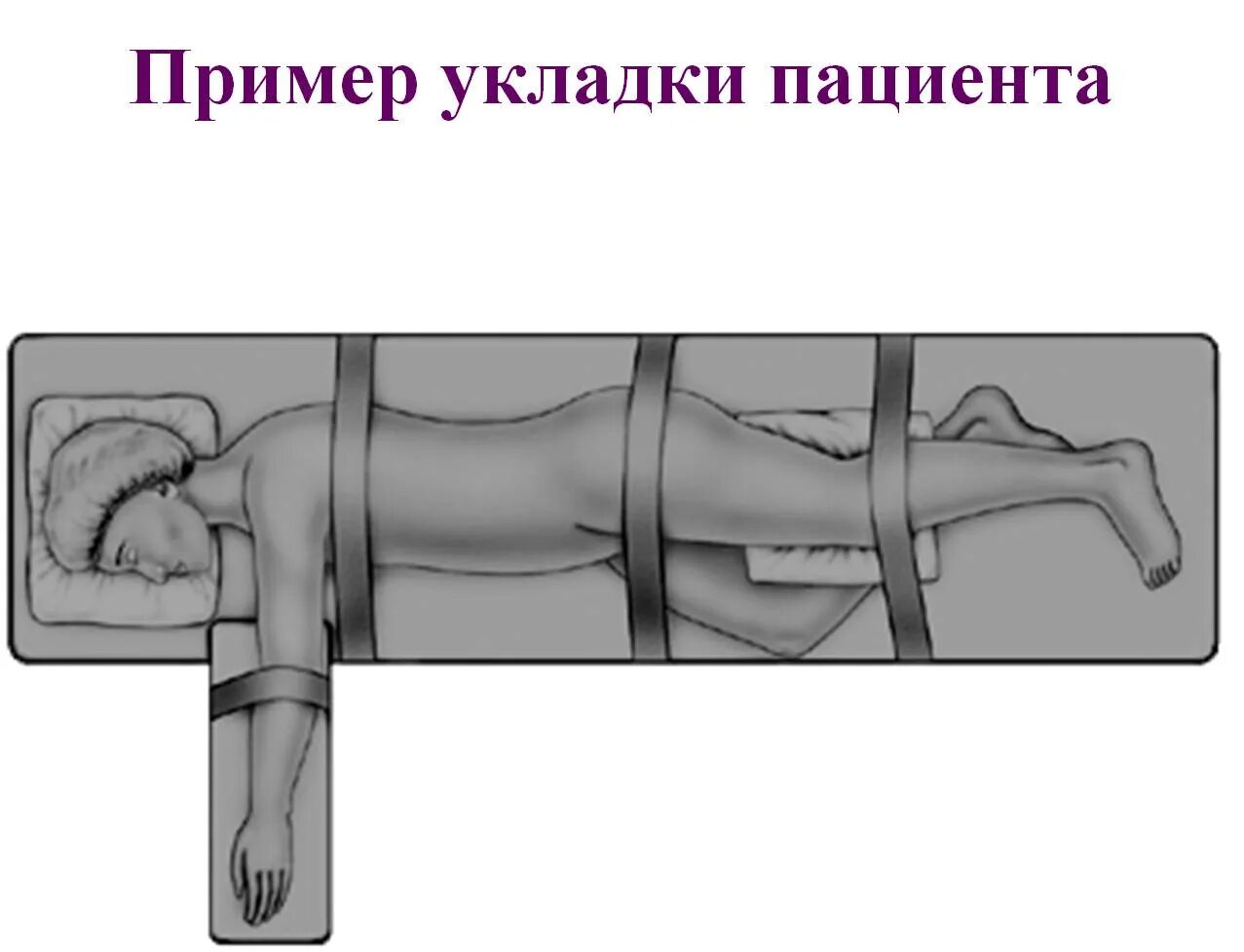 Клинические проявления грыжи межпозвонкового диска. Грыжа поясничного отдела. Грыжа позвоночника поясничного отдела клинические рекомендации. Гидромиелия шейного отдела позвоночника. Грыжа шейного отдела инвалидность.