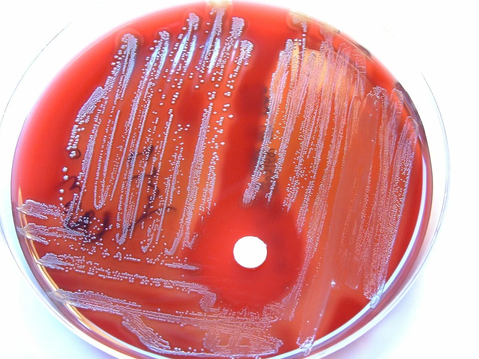 Streptococcus