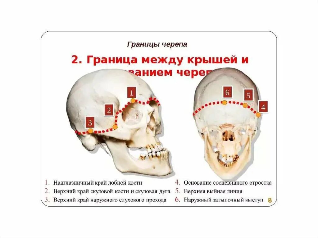 Основание черепа где. Граница свода и основания черепа. Свод и основание черепа. Свод черепа границы строение. Граница между сводом и основанием черепа.