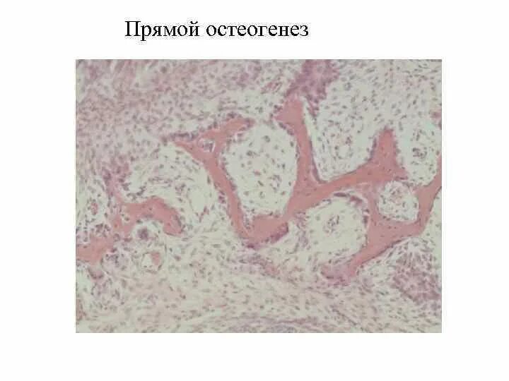 Гистология челюстей. Прямой остеогенез препарат гистология. развитие кости из мезенхимы прямой остеогенез.