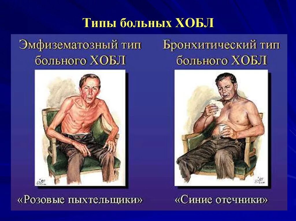 Наследственные болезни моногенные хромосомные полигенные. Причины заболевания. Типы заболевших людей. Типы заболевших людей. Классификация наследственных болезней генетика таблица.