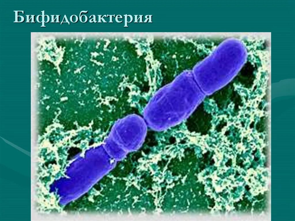 Бифидобактерии человек. Бифидобактерии инфантис. Бифидобактерии это царство. Бифидобактерии бифидум микроорганизмы. Бифидобактерии в микроскопе.