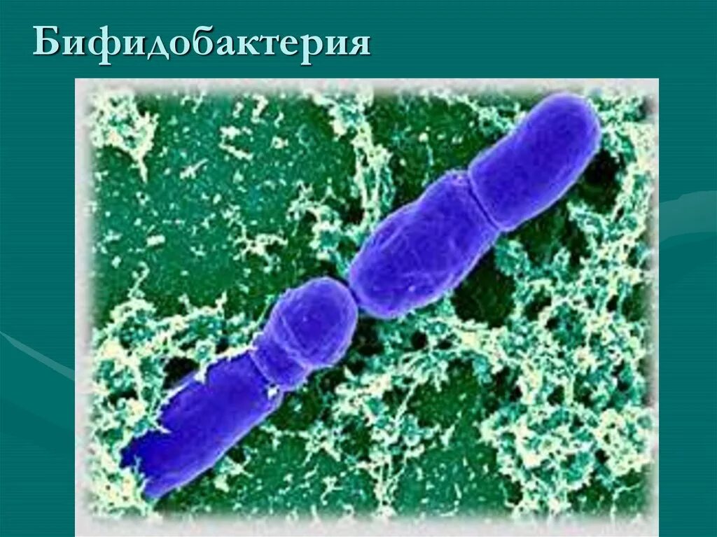 Бифидобактерии где. Бифидобактерии инфантис. Бифидобактерии это царство. Бифидобактерии бифидум микроорганизмы. Бифидобактерии в микроскопе.