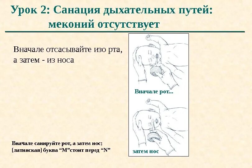Санация алгоритм. Санация верхних дыхательных путей у детей. санация верхних дыхательных путей у детей алгоритм. методика санации верхних дыхательных путей. проведение санации верхних дыхательных путей алгоритм.