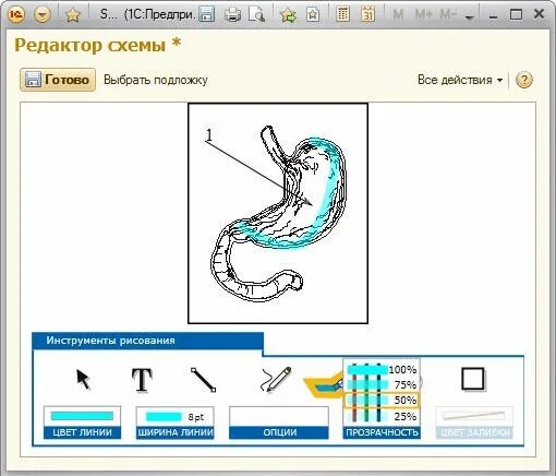 1с графическая схема. Редактор графической схемы 1с. Графическая схема бэкапирования 1с. Графическая схема в 1с медицина. Сэмд в медицине что это