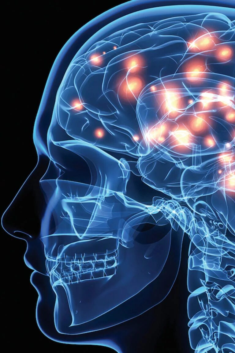 Потеря памяти. Исследование мозга. Мозг супер мозг.