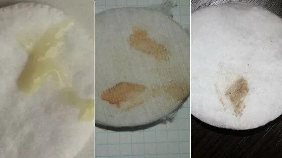 Возможны месячные при беременности на ранних сроках. Выделения при беременности на 2 недели беременности. ведетентя при беременности.