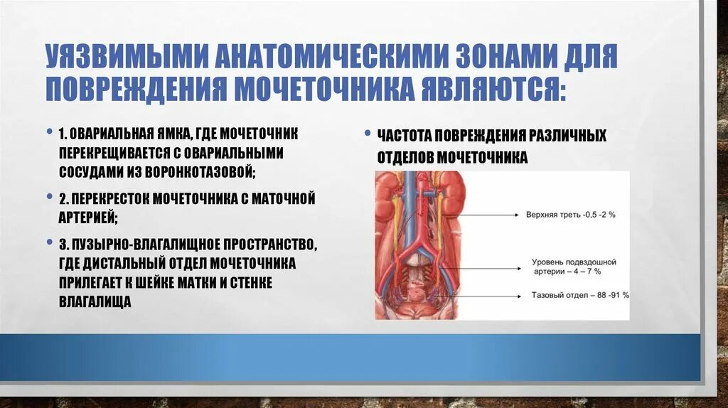 Маточная артерия и мочеточник. Перекрест мочеточника с маточной артерией. Взаимоотношения маточной артерии и мочеточника. Маточная артерия и мочеточник взаимоотношение.