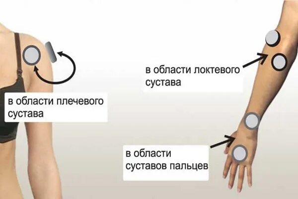 Витафон коленный сустав. Витафон фонирование почек. Фонирование суставов. Виброакустический прибор витафон. Витафон при артрозе коленного сустава.