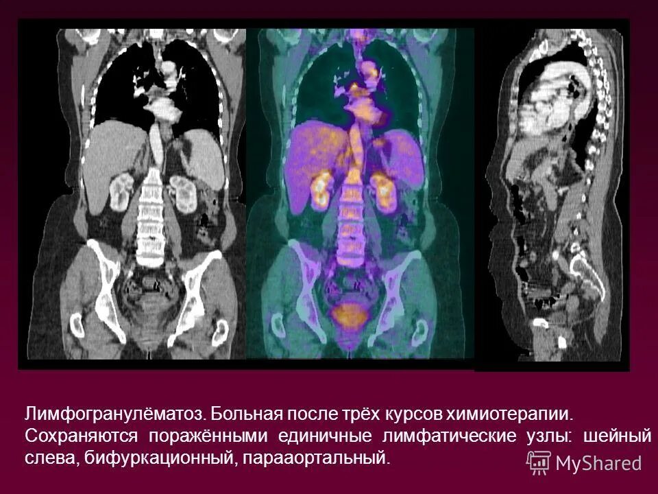 После трех курсов